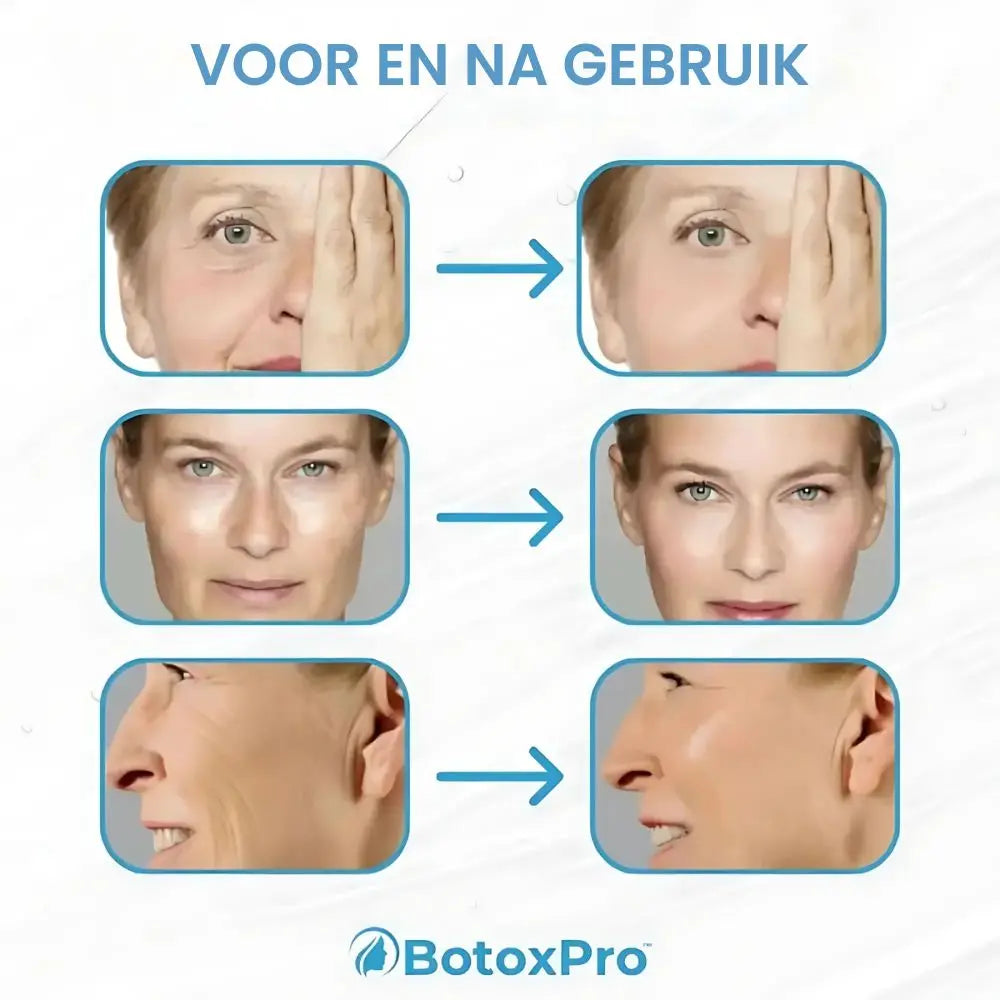BotoxPro™ serumas nuo raukšlių | Atrodykite 10 metų jaunesnė vos per 7 dienas!